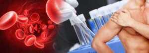 تاثیر و مزایای پی ار پی